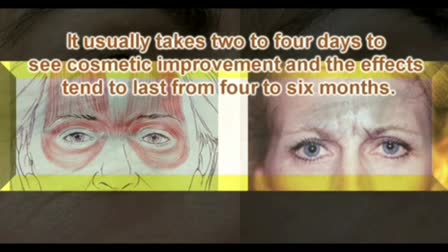 Botox information from Sound Bytes