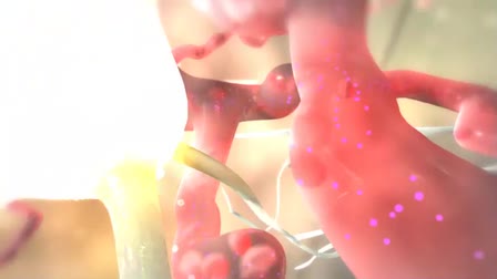 Medical Animation Demo Reel