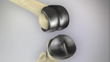 M3D Medical Animation Demo Reel