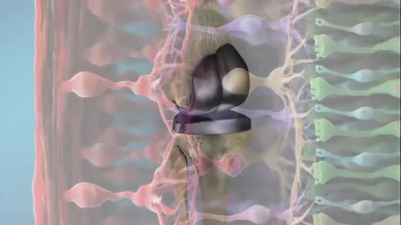 Medimage3D Medical Animation Demo Reel