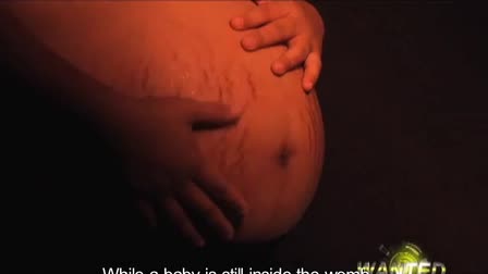 Abortionist