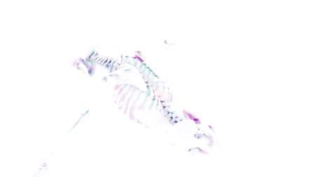 Medical Animation