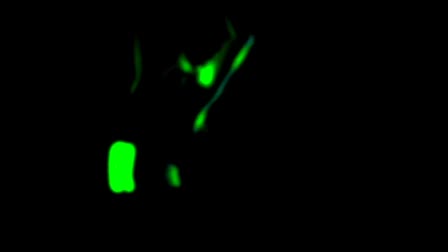 REANIMATION
