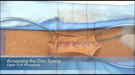 Medical Video Examples