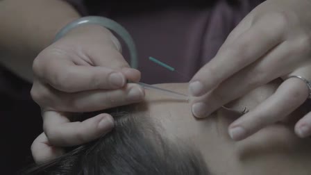About Video "Garden Acupuncture" 