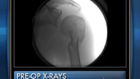 Surgical Video